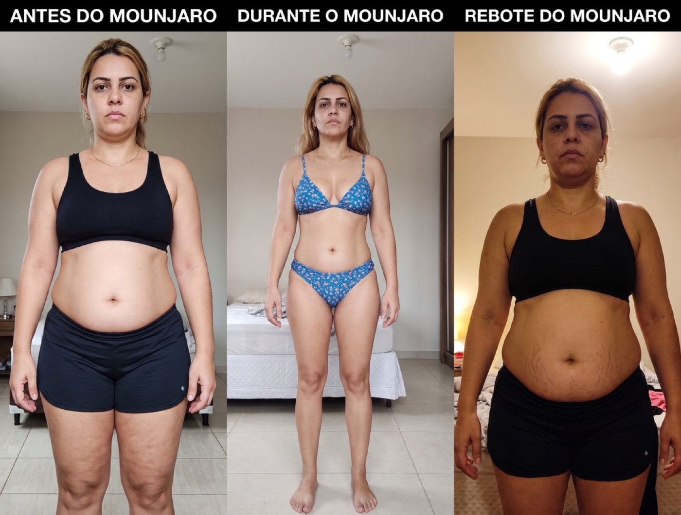 Antes e depois — paciente que saiu da caneta